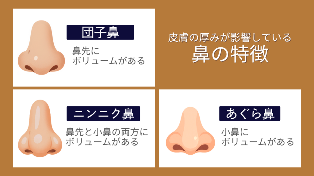 団子鼻・あぐら鼻・ニンニク鼻の特徴