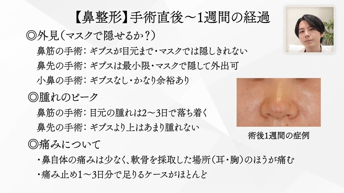 【鼻整形】手術直後~1週間の経過