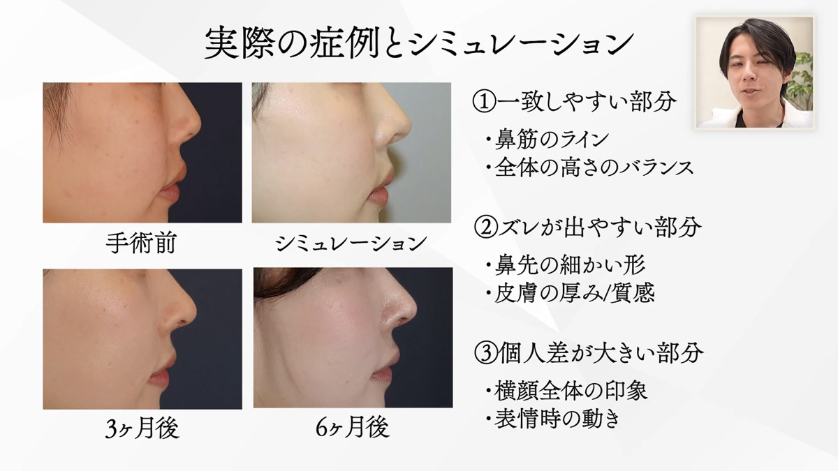 実際の症例とシミュレーション