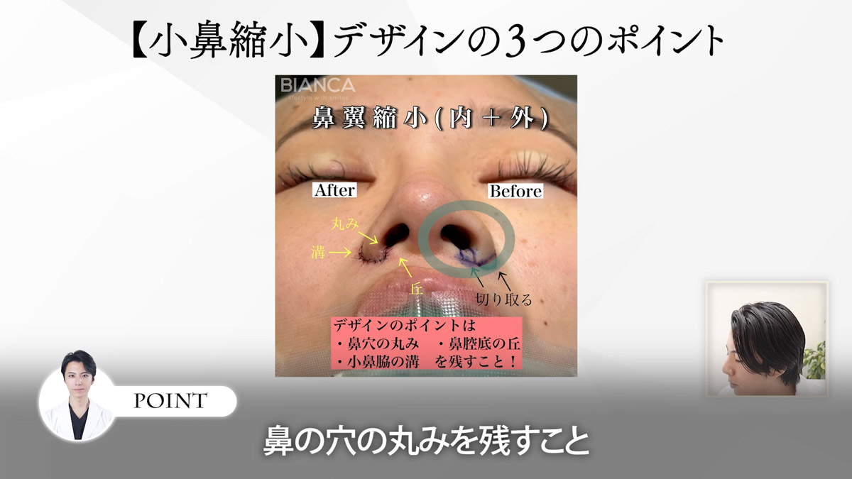 ポイント① 鼻の穴の"丸み"を残す