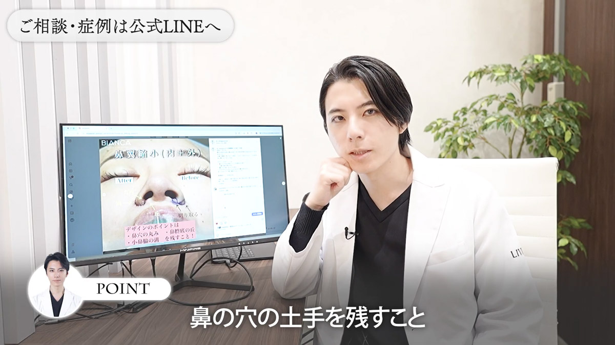 ポイント② 鼻の穴の"土手"を残す