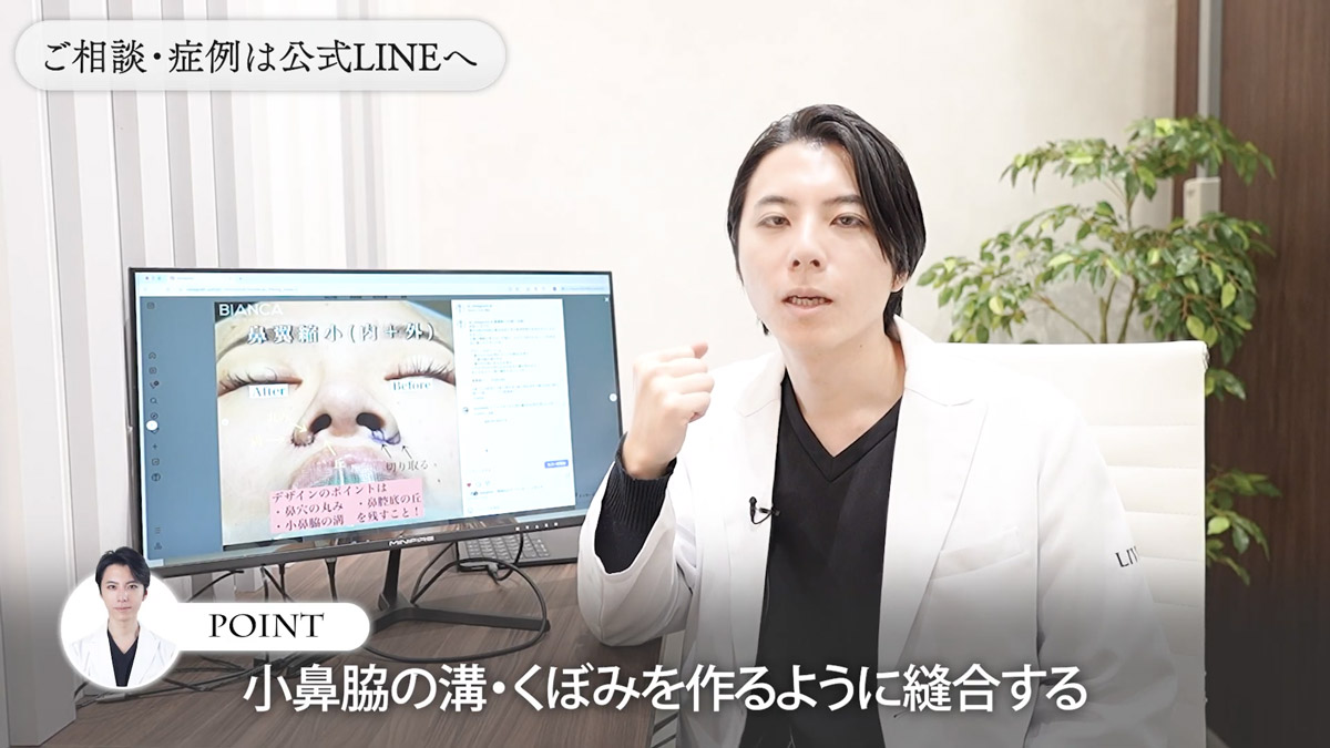 ポイント③ 小鼻の"溝"を残してしっかり縫う