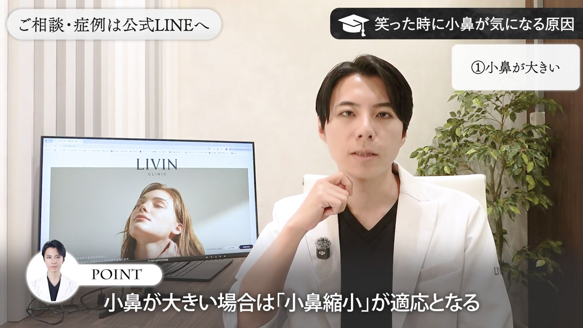 原因① シンプルに小鼻自体が大きい