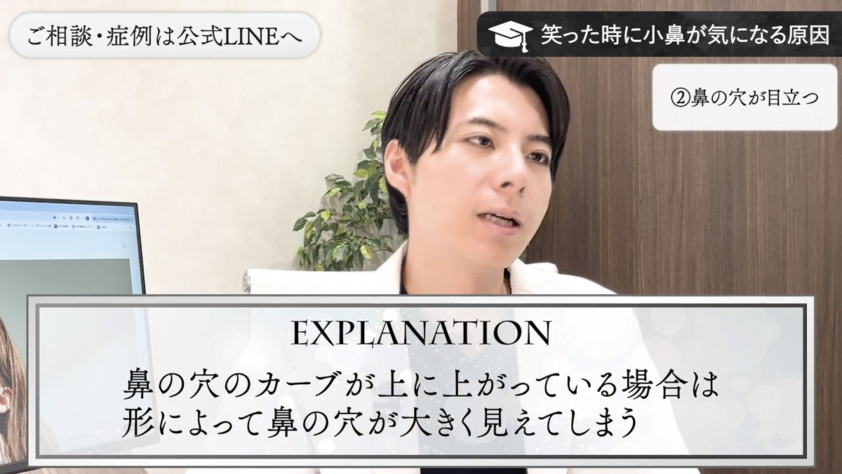 原因② 鼻の穴の“見え方”が大きい(鼻孔縁が上がっている)