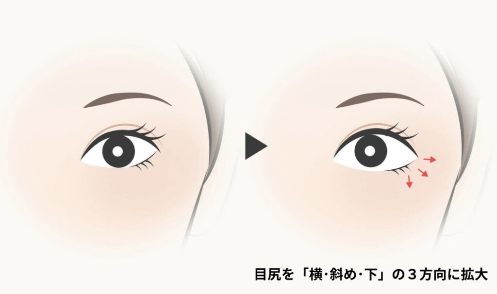 「3WAY目尻拡大」拡大方向の図解