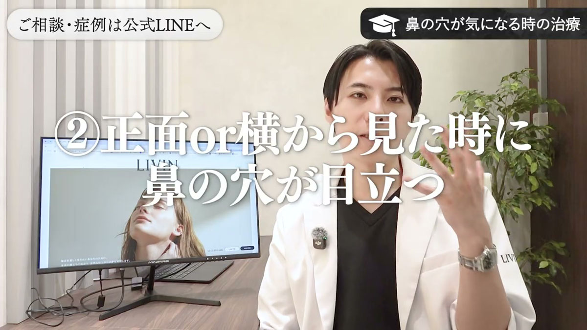 パターン②|正面・横から見て鼻の穴が目立つ場合