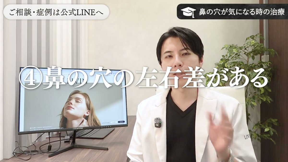 パターン④|鼻の穴に左右差がある場合