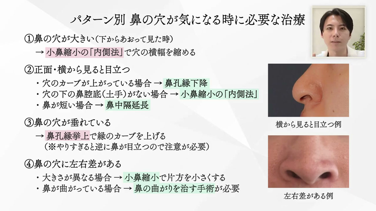 パターン別 鼻の穴が気になる時に必要な治療