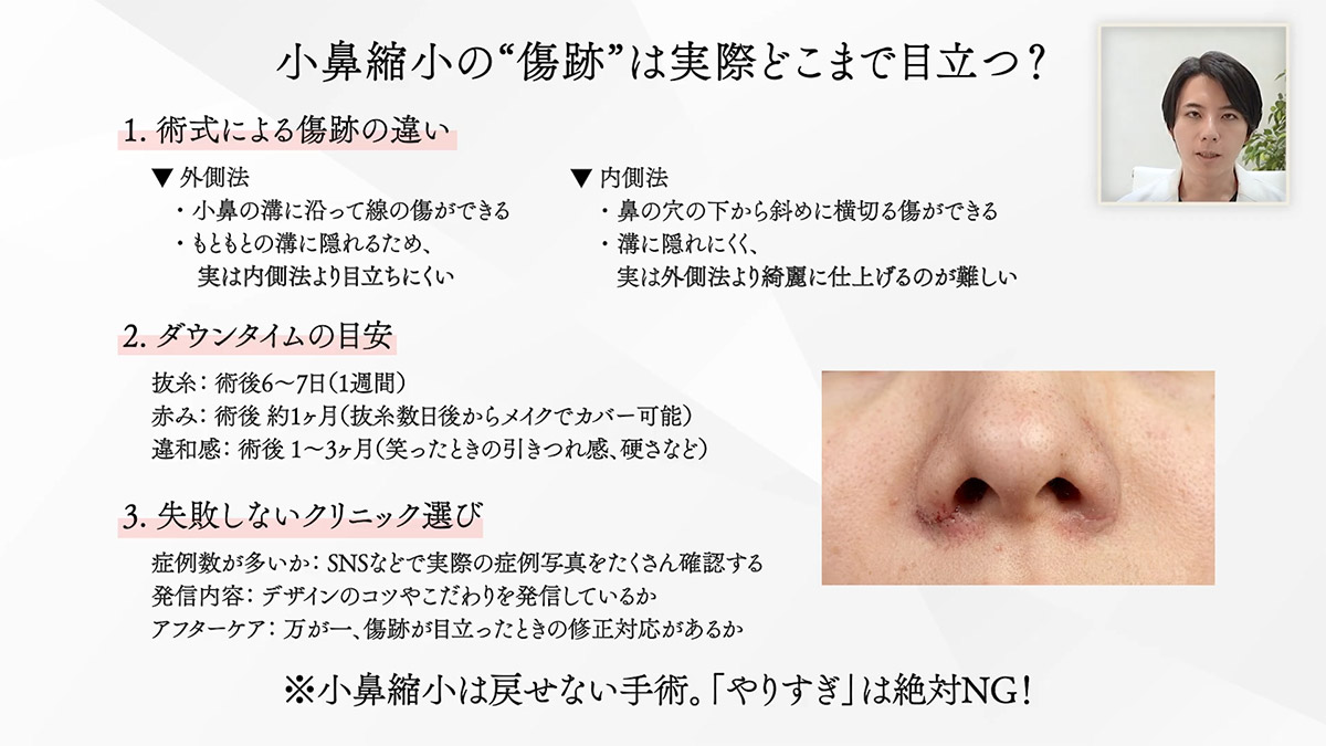 小鼻縮小の傷跡は実際どこまで目立つ?