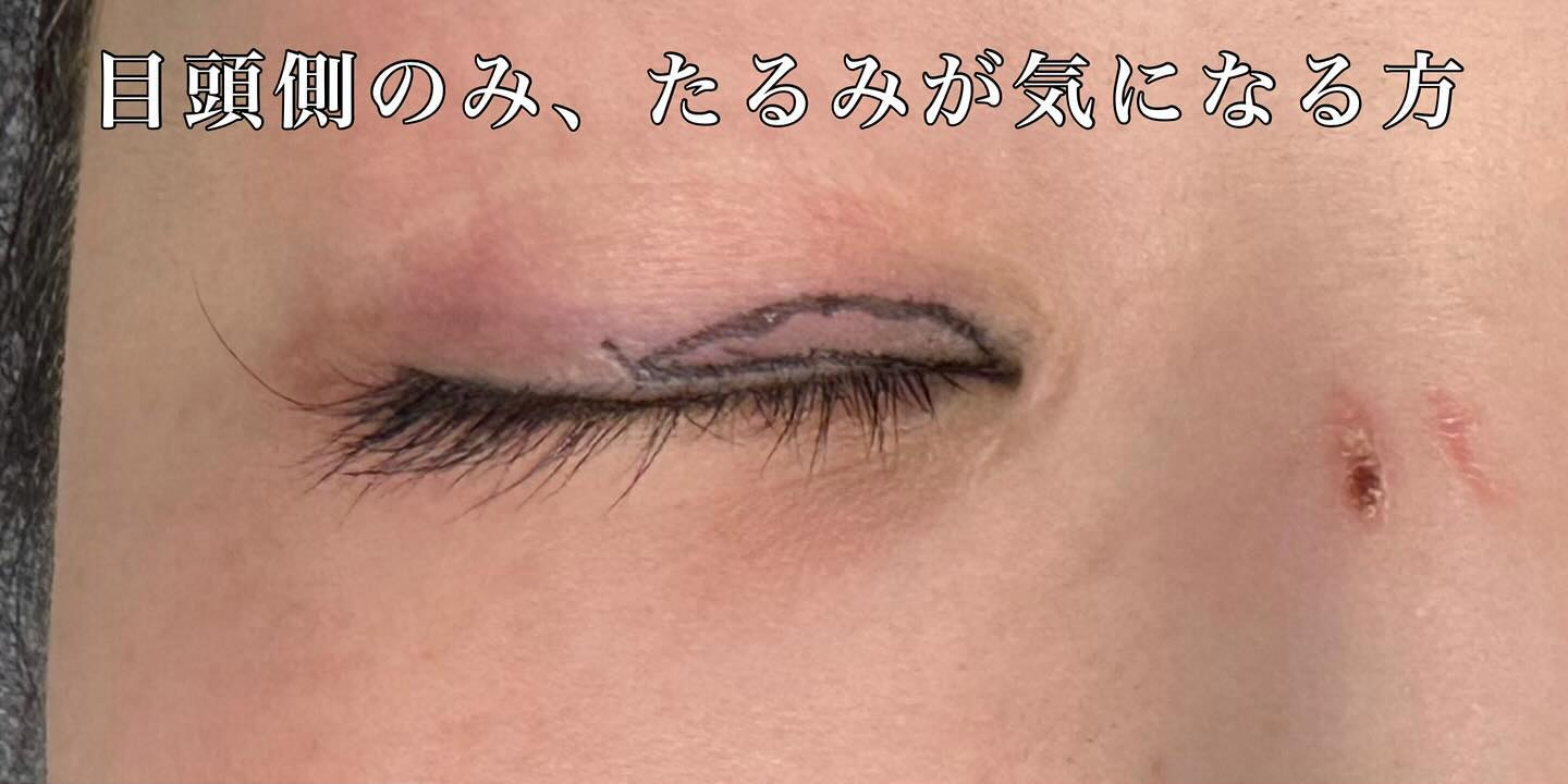 症例②