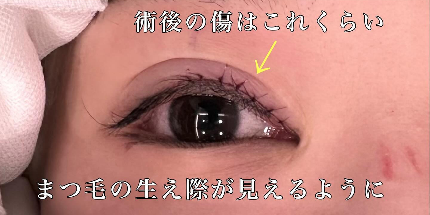 症例②