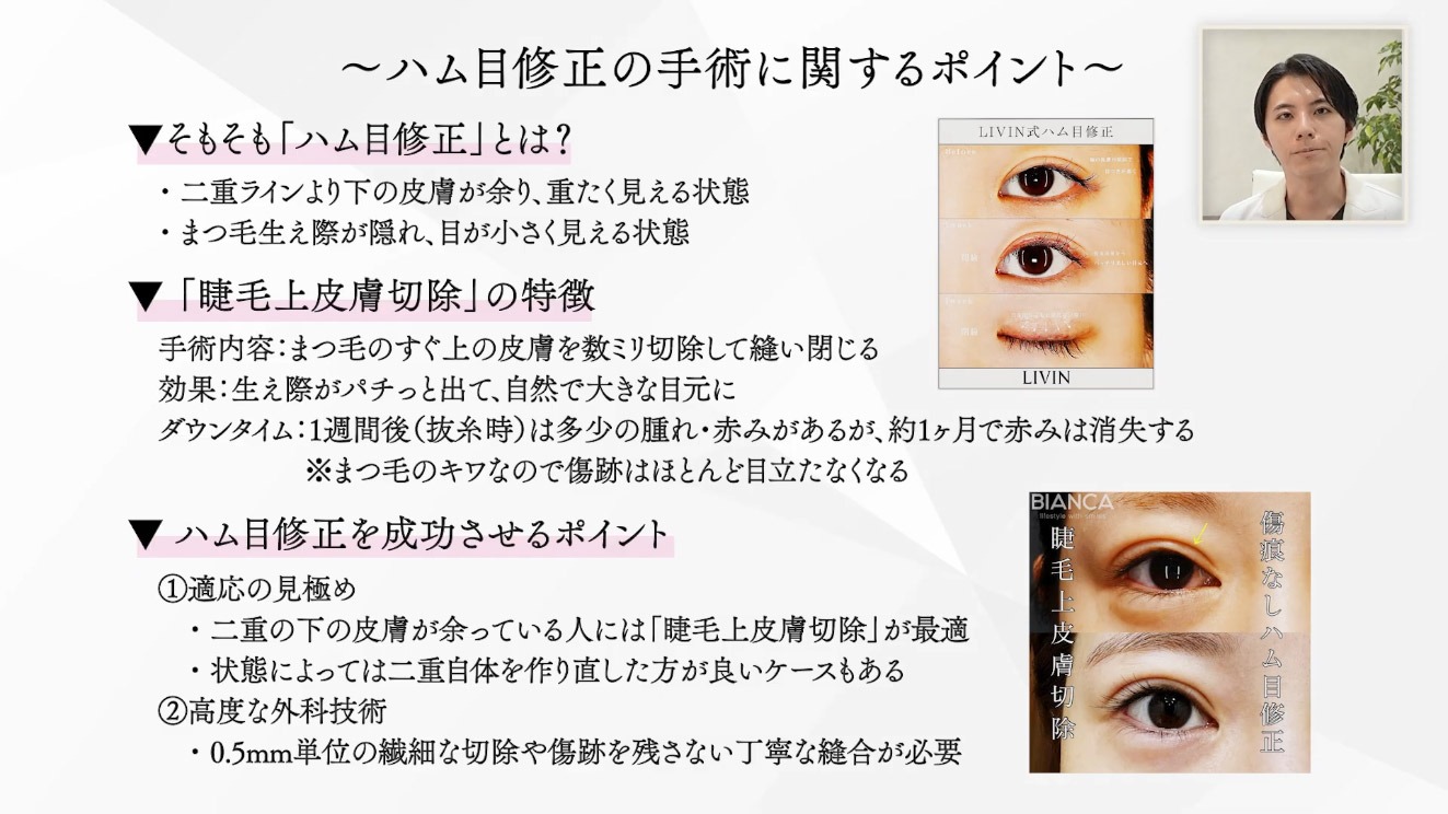 ハム目修正の手術に関するポイント