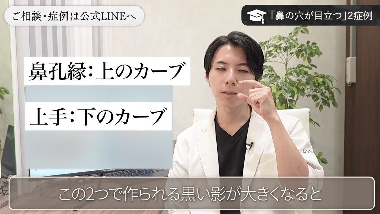 鼻孔縁(上のカーブ)と土手(下のカーブ)について説明する新行内