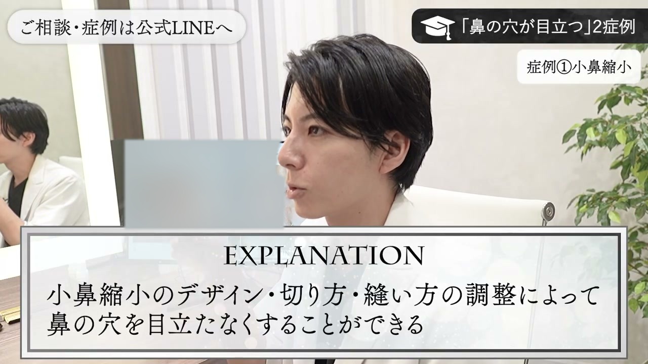 小鼻縮小のデザイン・切り方・縫い方の調整について説明する新行内