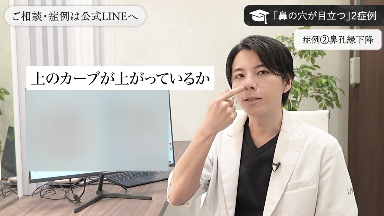 上のカーブが上がっているかどうかで施術を選ぶと説明する新行内