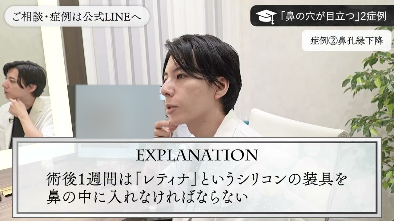 鼻孔縁下降の術後に装着するシリコンの装具について説明する新行内